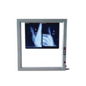 X Ray Viewer