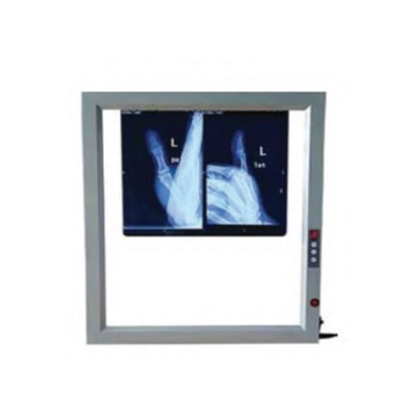 X Ray Viewer